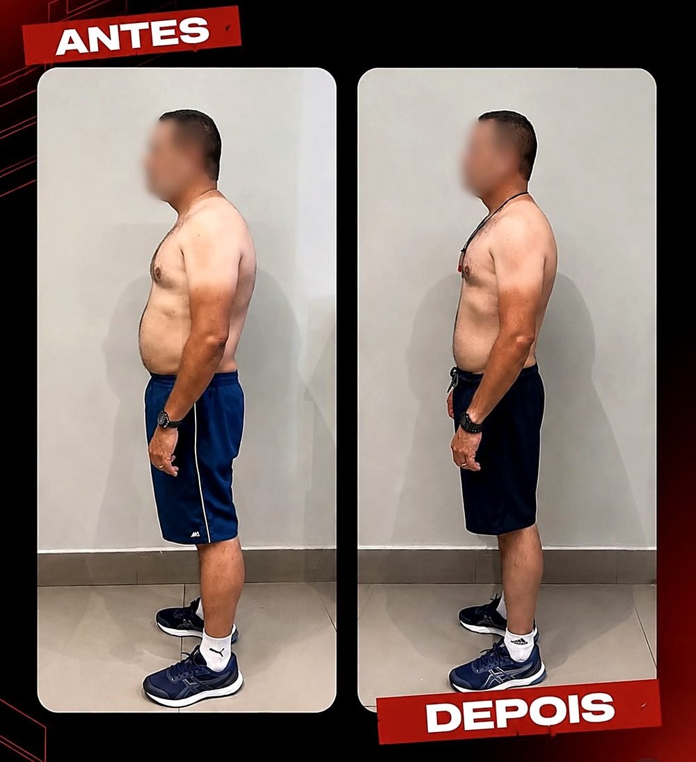 Antes e depois de aluno do atendimento presencial, melhora de postura e dores